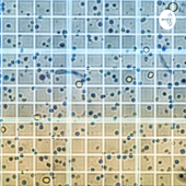 المناعة وبيولوجيا السرطان - Cancer Biology & Immunology